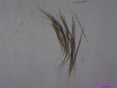 Aphanizomenon