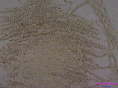 Aphanizomenon