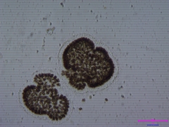 Woronichinia