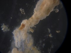 Cibicidoides variabilis