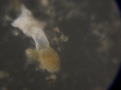 Quinqueloculina