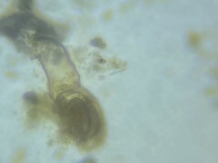 Quinqueloculina