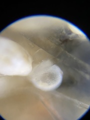 Oolina lineata