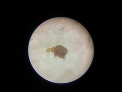 Bathyphantes