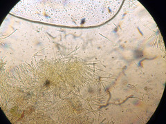 Lachnellula resinaria