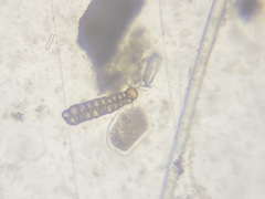 Bolivina