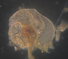 Cibicidoides