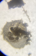 Cibicidoides