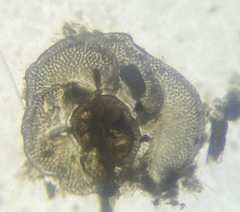 Cibicidoides