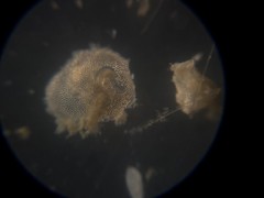Cibicidoides