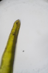 Racomitrium sudeticum