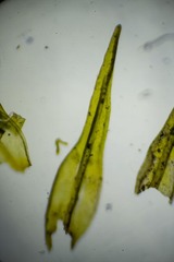 Racomitrium sudeticum