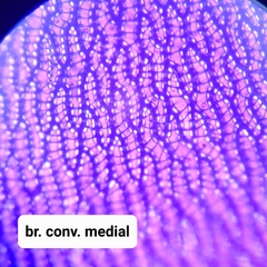 Sphagnum platyphyllum