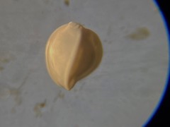 Cruciloculina triangularis