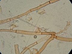 Botryobasidium rubiginosum