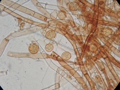 Botryobasidium rubiginosum