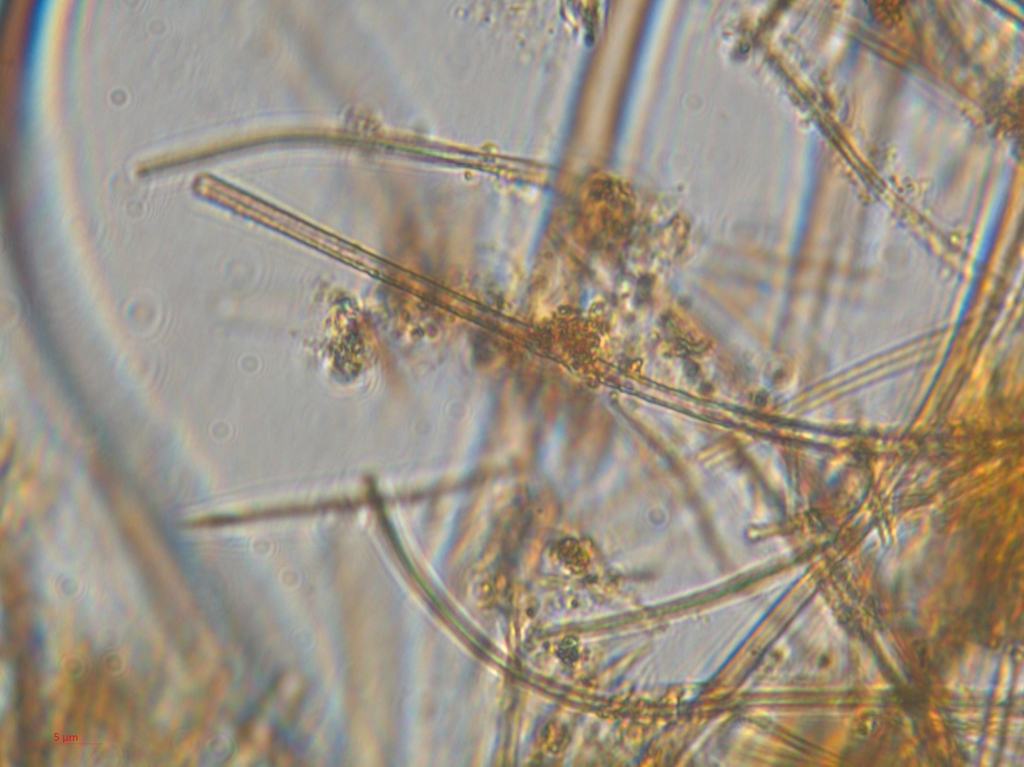 Leptothrix ochracea