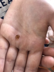 Psyllobora lutescens