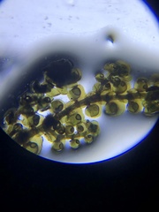 Frullania brittoniae