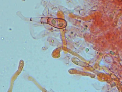 Rhizocybe