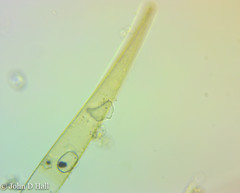 Closterium striolatum