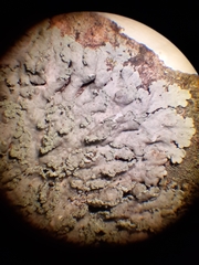 Heterodermia albicans