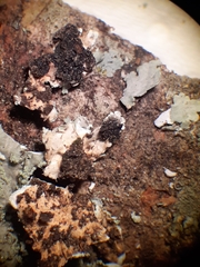 Heterodermia albicans