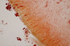 Auricularia mesenterica