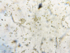 Lycoperdon echinella