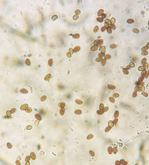 Coprinellus truncorum