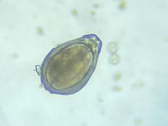 Fissurina varioperforata