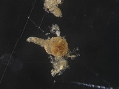 Trochammina inflata