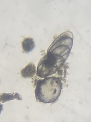 Nonionella auris