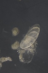 Nonionella auris
