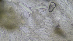 Pertusaria pustulata