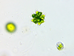 Sorastrum spinulosum