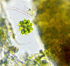 Sorastrum spinulosum