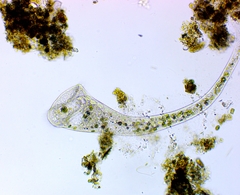Stentor muelleri