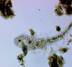 Stentor muelleri