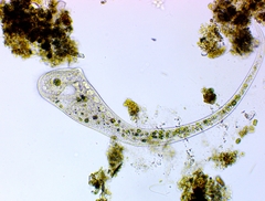 Stentor muelleri