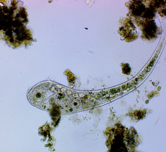 Stentor muelleri