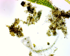 Stentor muelleri