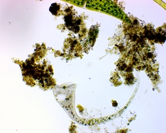 Stentor muelleri