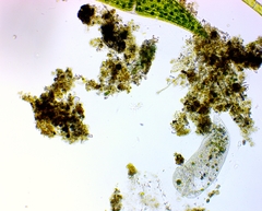Stentor muelleri