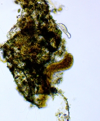 Chaetonotus