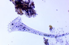Stentor muelleri
