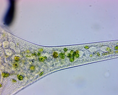 Stentor muelleri