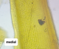 Racomitrium microcarpon