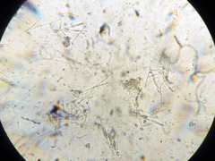 Lachnum subvirgineum