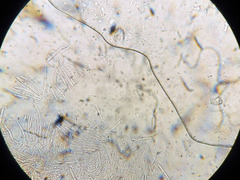 Lachnum subvirgineum